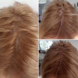 سرم مولتی پپتید تقویت مو اوردینری (The Ordinary Multi-Peptide Serum)